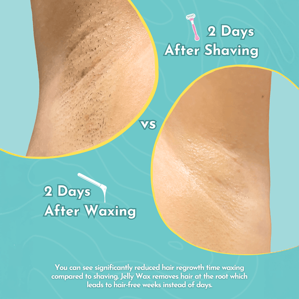 Jelly Wax® All-In-One Wax Kit