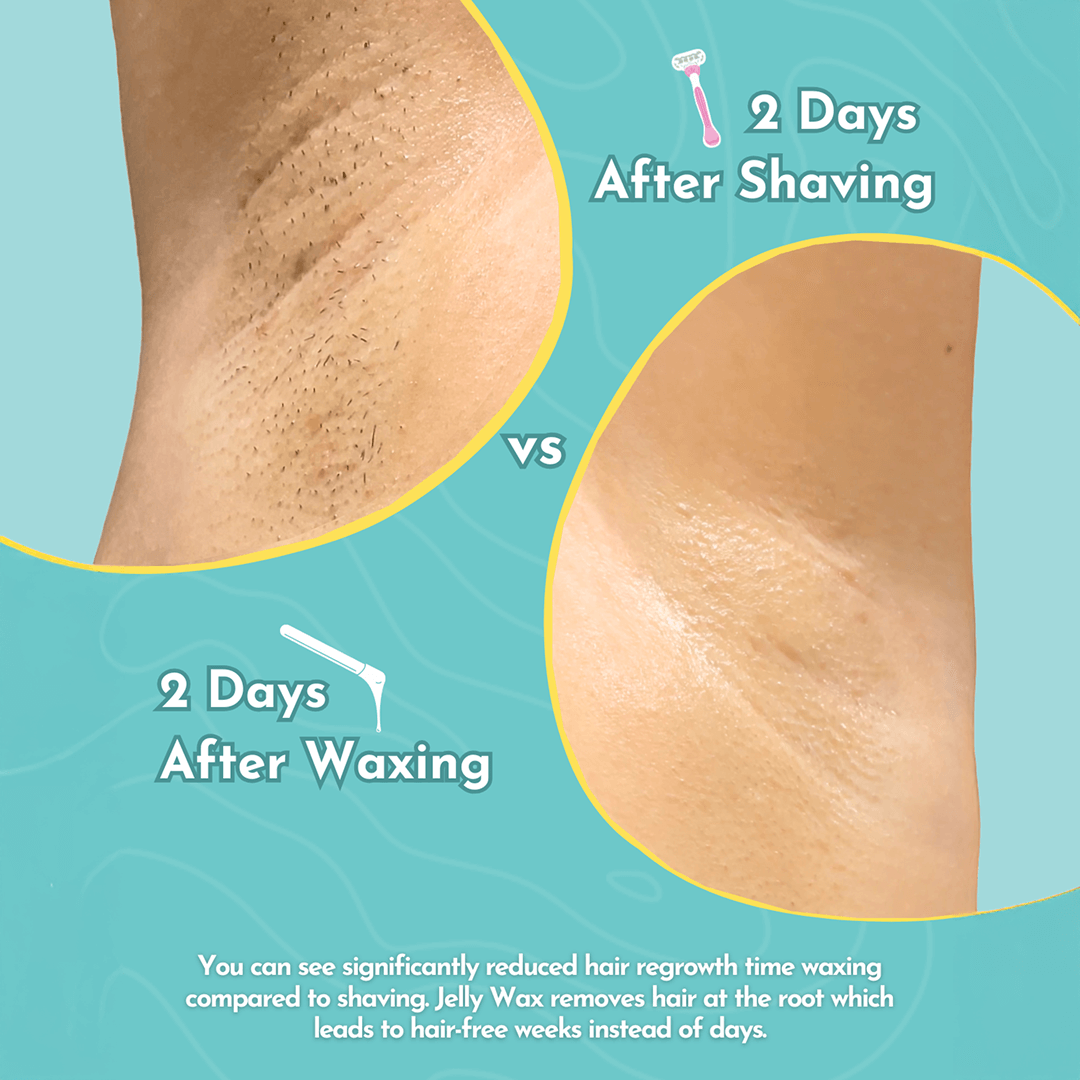 Jelly Wax® All-In-One Wax Kit