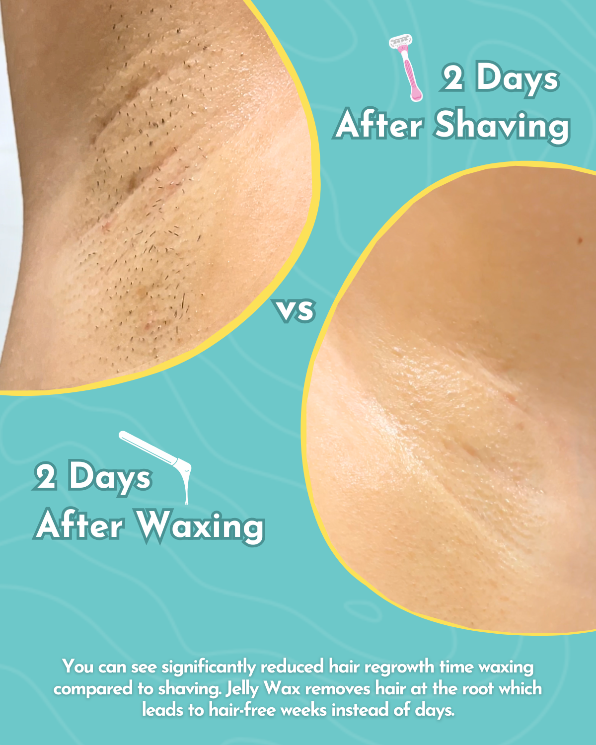 Jelly Wax® All-In-One Wax Kit